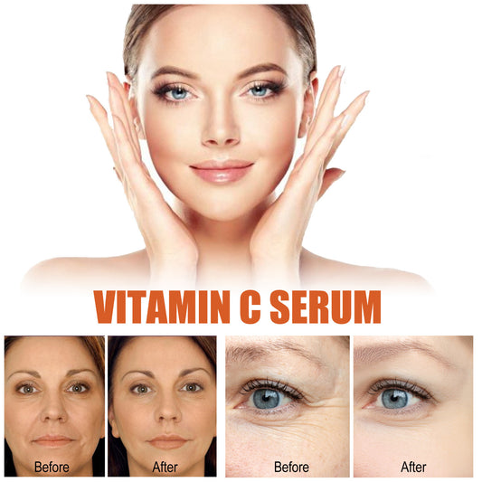 Anti-Aging Whitening Vitamin C Care Solution